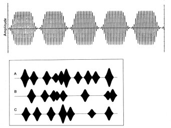 La synthèse granulaire La synthèse granulaire