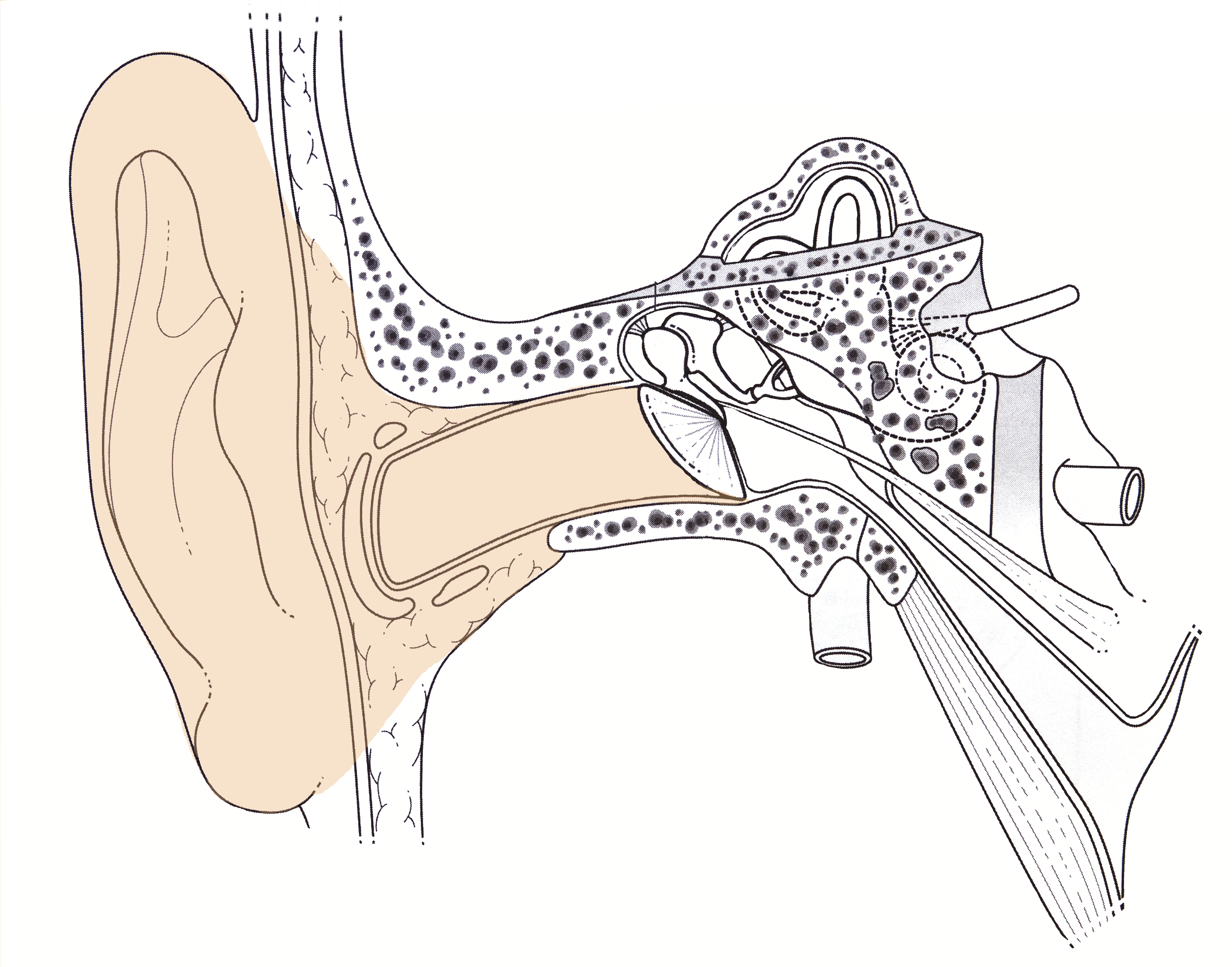 La loudness war et le syst&egrave;me auditif