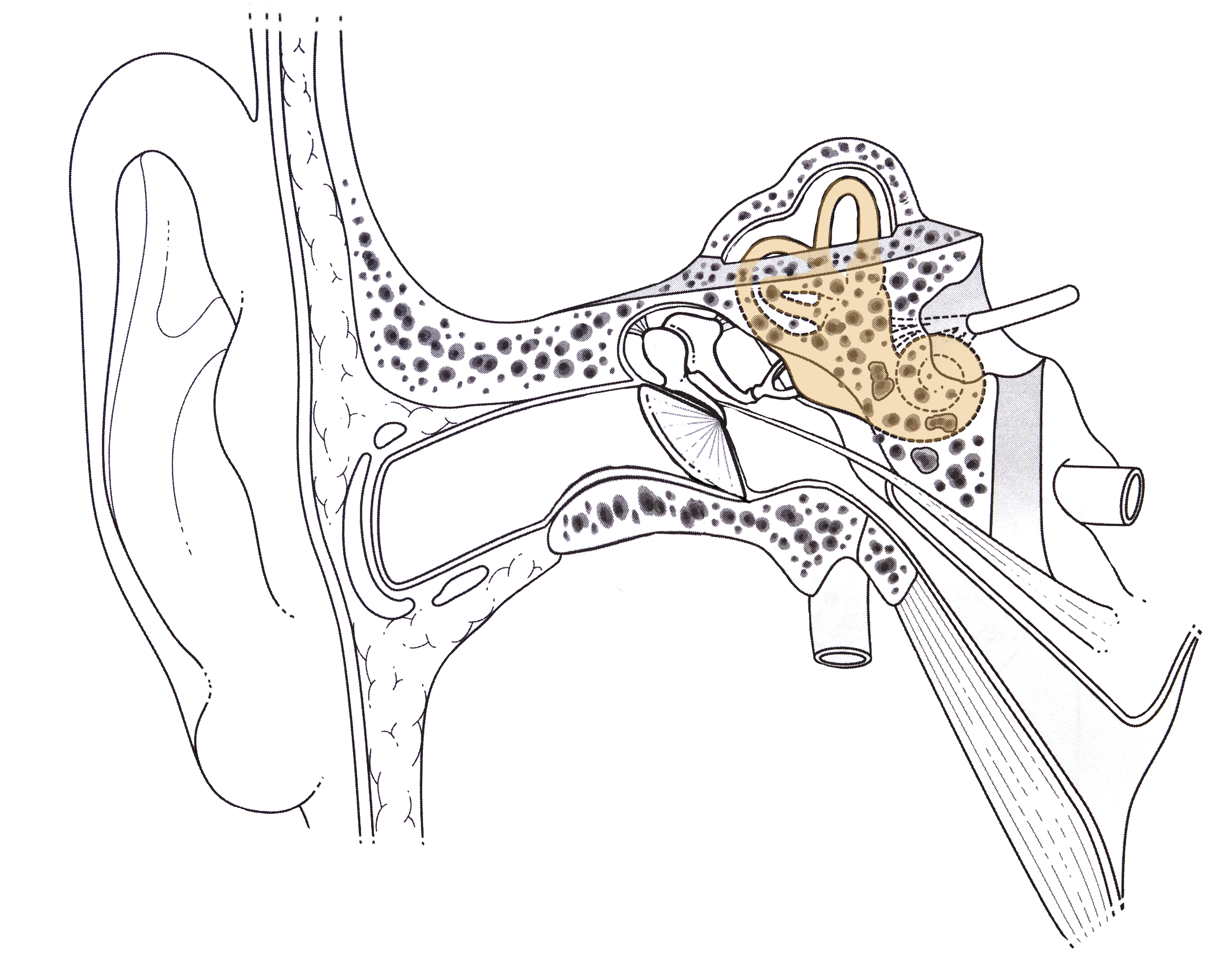 La loudness war et le syst&egrave;me auditif