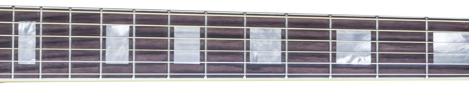 ACMGBEGH1 NECK SIDE