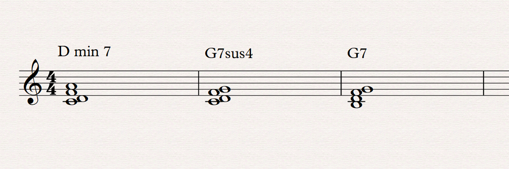 p&eacute;dale de retard