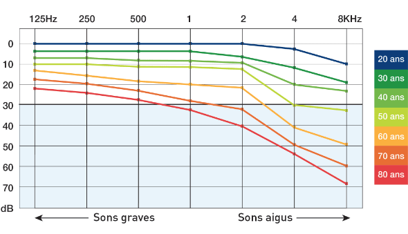 schema-perte-auditive
