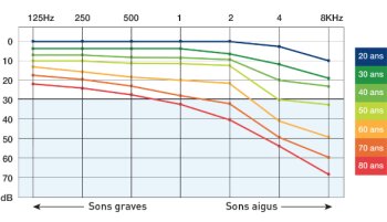 schema-perte-auditive schema-perte-auditive