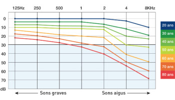 schema-perte-auditive schema-perte-auditive