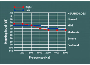 Hornet Plugins HoRNet VHS (7621)